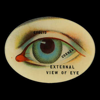External View of Eye - FINAL SALE