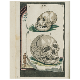 Skulls (p 172)