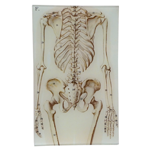 Bones - FINAL SALE